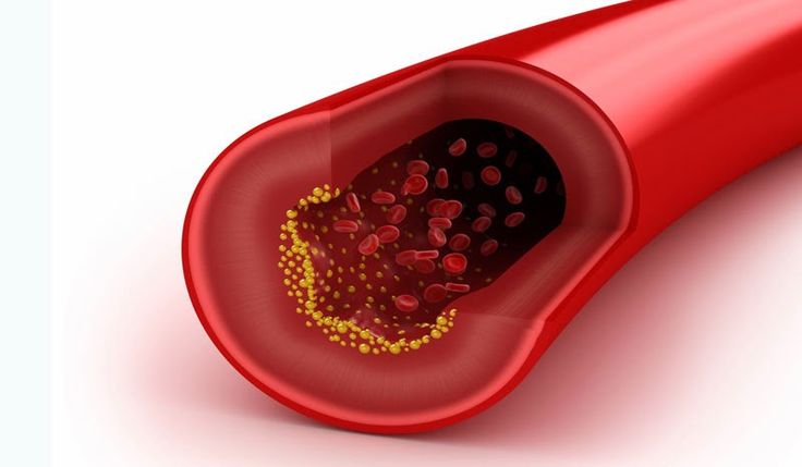 Германски природен лек: Чисти артерии, намалува холестерол